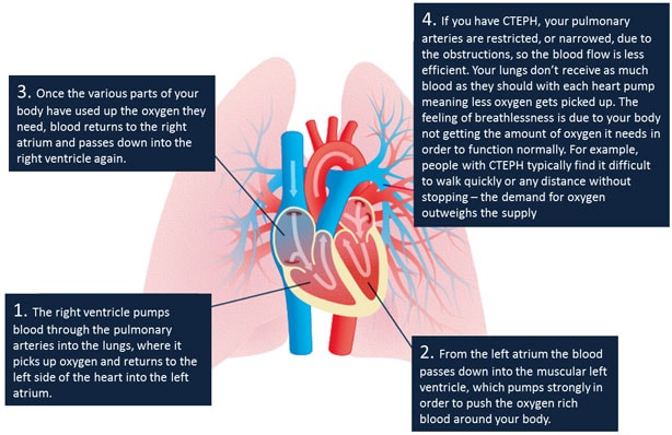 Cteph discount